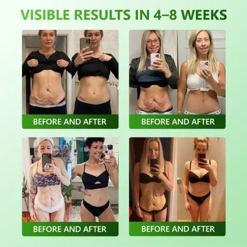 ๐
๐ข๐ซ๐ฆ๐ข๐ง๐ & ๐๐ง๐ญ๐ข-๐๐ซ๐ข๐ง๐ค๐ฅ๐ ๐๐ญ๐๐ฆ ๐๐๐ฅ๐ฅ ๐๐จ๐ฅ๐ฅ๐๐ ๐๐ง ๐๐ซ๐จ๐ฉ๐ฌ - Image 4