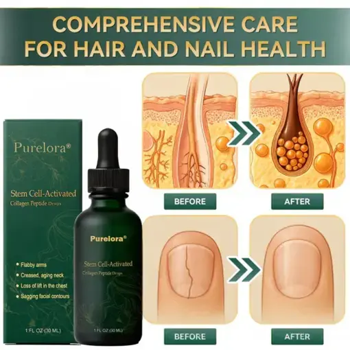 ๐ฆ๐๐ฒ๐บ ๐๐ฒ๐น๐นโ๐๐ฐ๐๐ถ๐๐ฎ๐๐ฒ๐ฑ ๐๐ผ๐น๐น๐ฎ๐ด๐ฒ๐ป ๐ฃ๐ฒ๐ฝ๐๐ถ๐ฑ๐ฒ ๐ฑ๐ฟ๐ผ๐ฝ๐ - Image 16