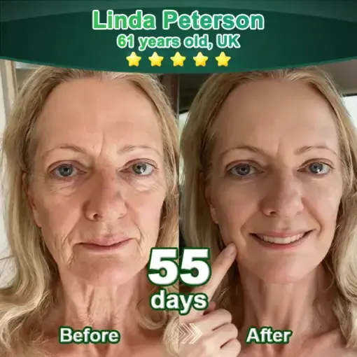 ๐ฆ๐๐ฒ๐บ ๐๐ฒ๐น๐นโ๐๐ฐ๐๐ถ๐๐ฎ๐๐ฒ๐ฑ ๐๐ผ๐น๐น๐ฎ๐ด๐ฒ๐ป ๐ฃ๐ฒ๐ฝ๐๐ถ๐ฑ๐ฒ ๐ฑ๐ฟ๐ผ๐ฝ๐ - Image 3