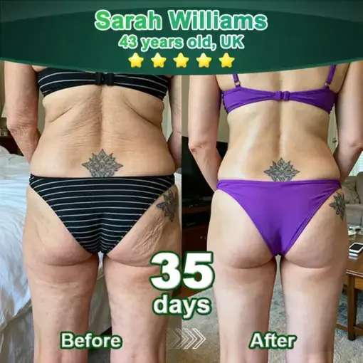 ๐ฆ๐๐ฒ๐บ ๐๐ฒ๐น๐นโ๐๐ฐ๐๐ถ๐๐ฎ๐๐ฒ๐ฑ ๐๐ผ๐น๐น๐ฎ๐ด๐ฒ๐ป ๐ฃ๐ฒ๐ฝ๐๐ถ๐ฑ๐ฒ ๐ฑ๐ฟ๐ผ๐ฝ๐ - Image 4