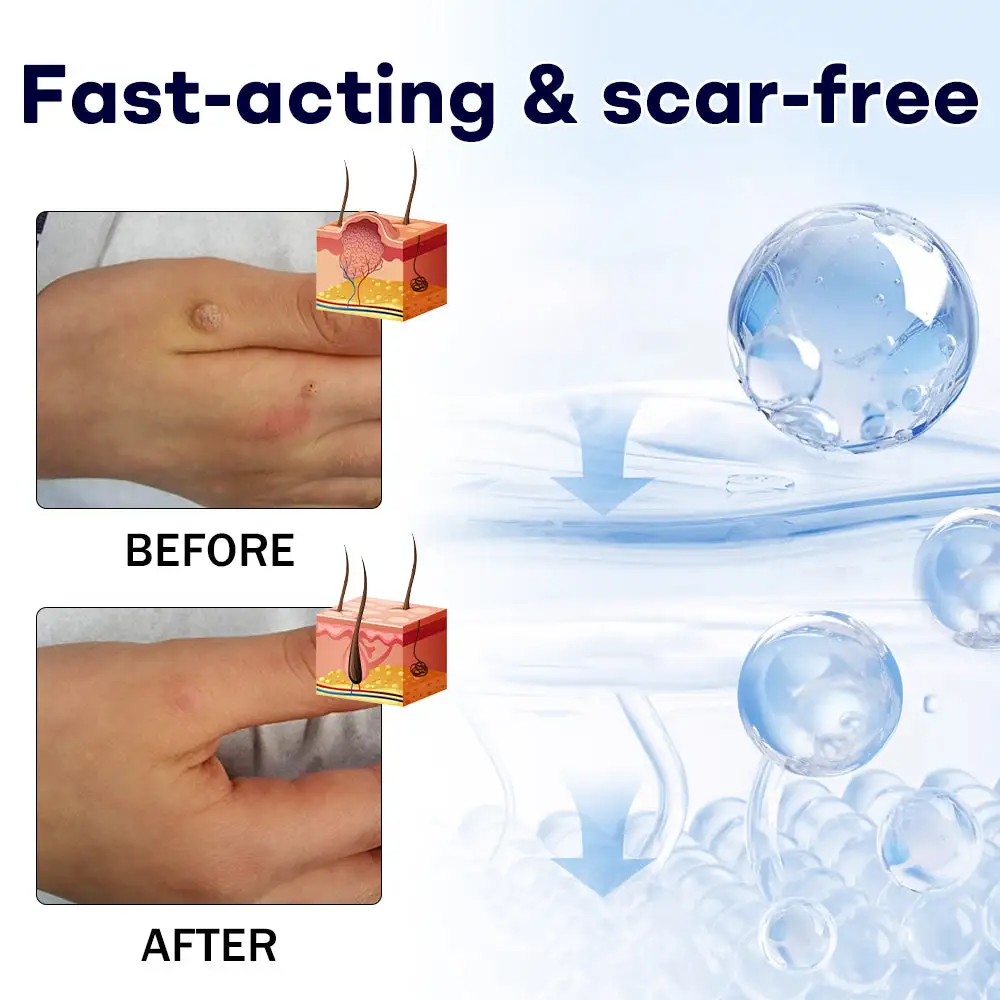 WartLock CRYO RECOVERY SPRAY - Image 5