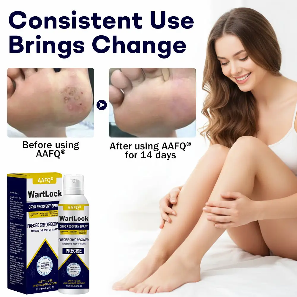 WartLock CRYO RECOVERY SPRAY - Image 6