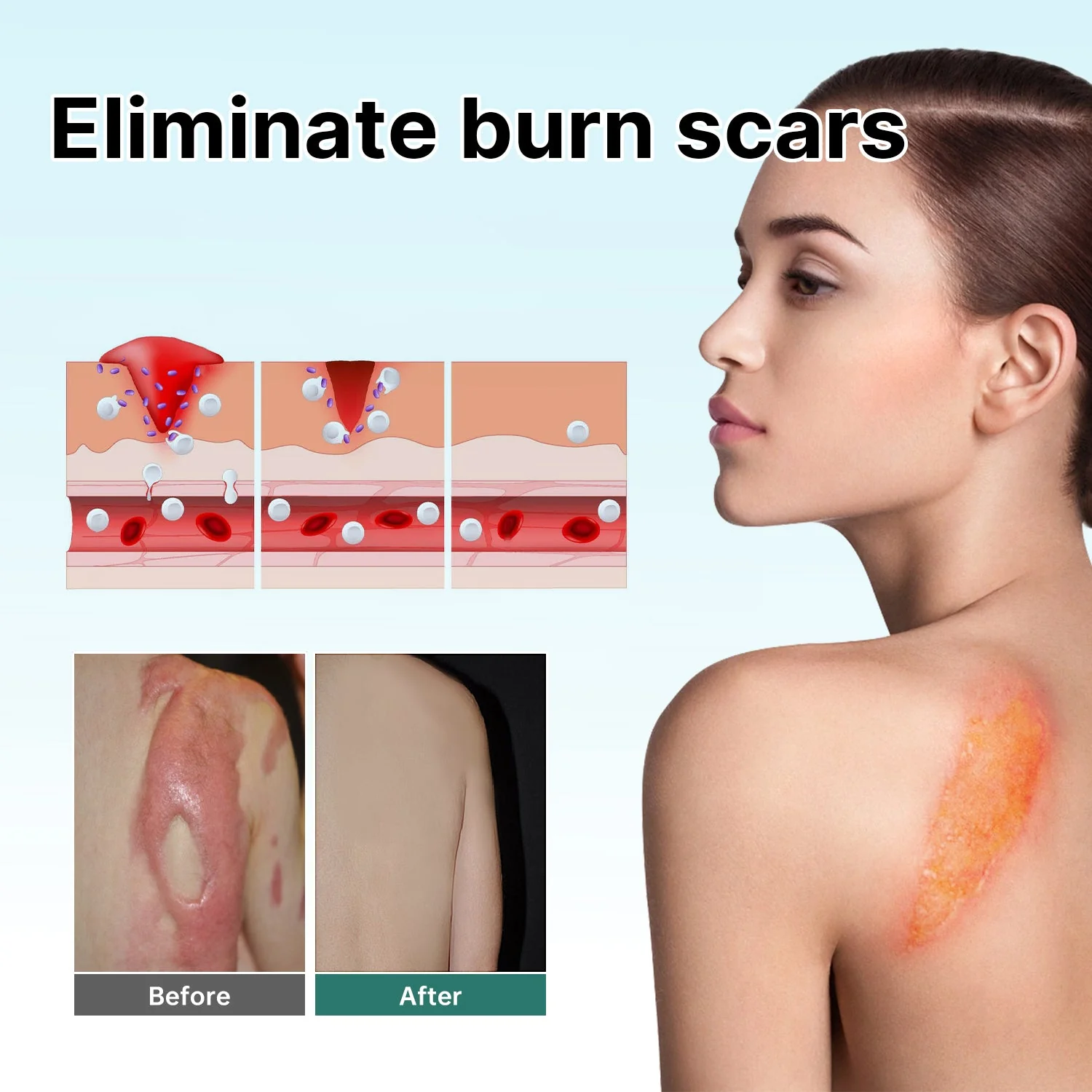 Natural Scar Removal Spray - Image 6