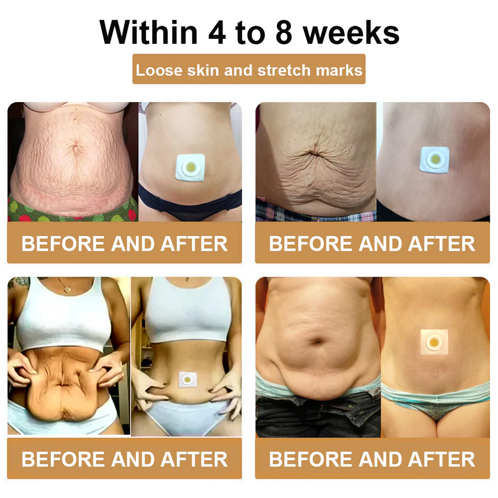 Bee Venom Lymphatic Drainage Slimming Patch - Image 4