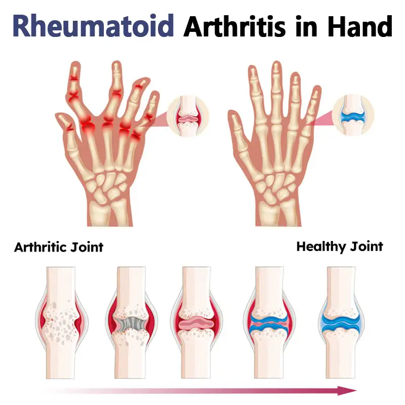 New Zealand Bee Venom Joint and Bone Therapy Advanced Cream - Image 3