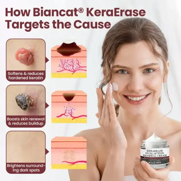 KeraErase Dual-Action Renewal Cream - Image 2