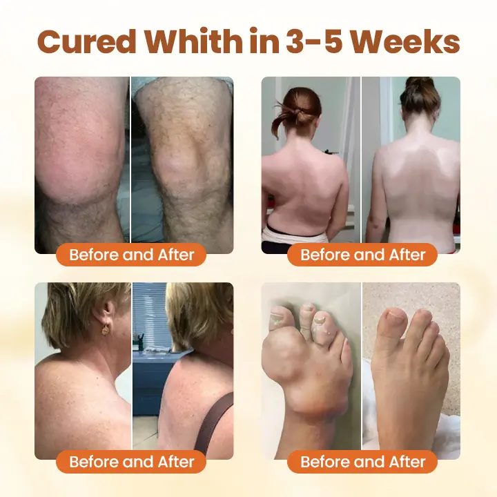 Premium Curcumin Pain Relief Gel - Image 2