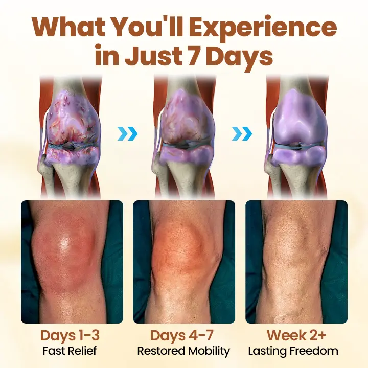 Premium Curcumin Pain Relief Gel - Image 6