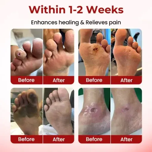 DiaCare Diabetic Treatment Cream - Image 5