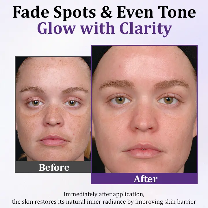 PigmentaX ProFade Anti-Hyperpigmentation Cream - Image 4