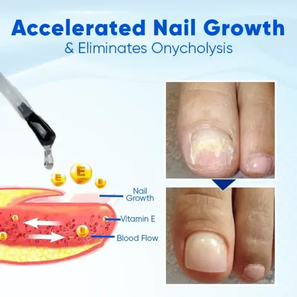 NailRebuild Nail Growth and Repair Serum+ - Image 5