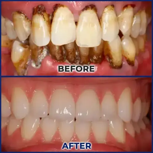 ApiGuard BeeVenom Therapeutic Oral Drops & Rinse - Image 2