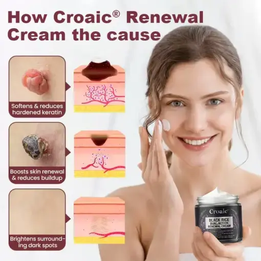 KeraErase RICEDUAL-ACTION RENEWAL CREAM - Image 2