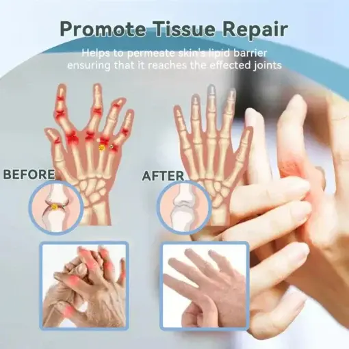 Nerve Repair &Pain Relief Magnesium Cream - Image 5