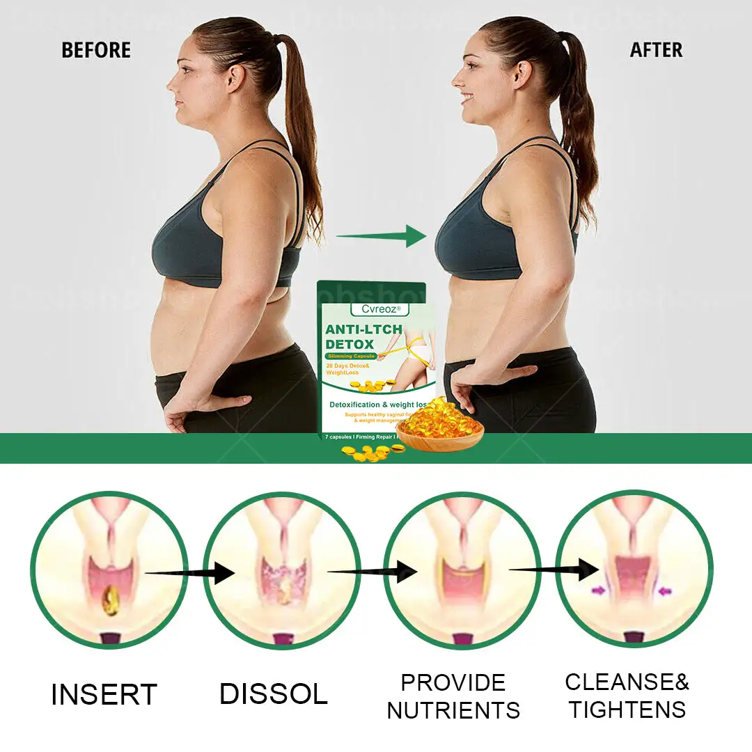 Anti-ltch Detox Slimming Capsule - Image 4