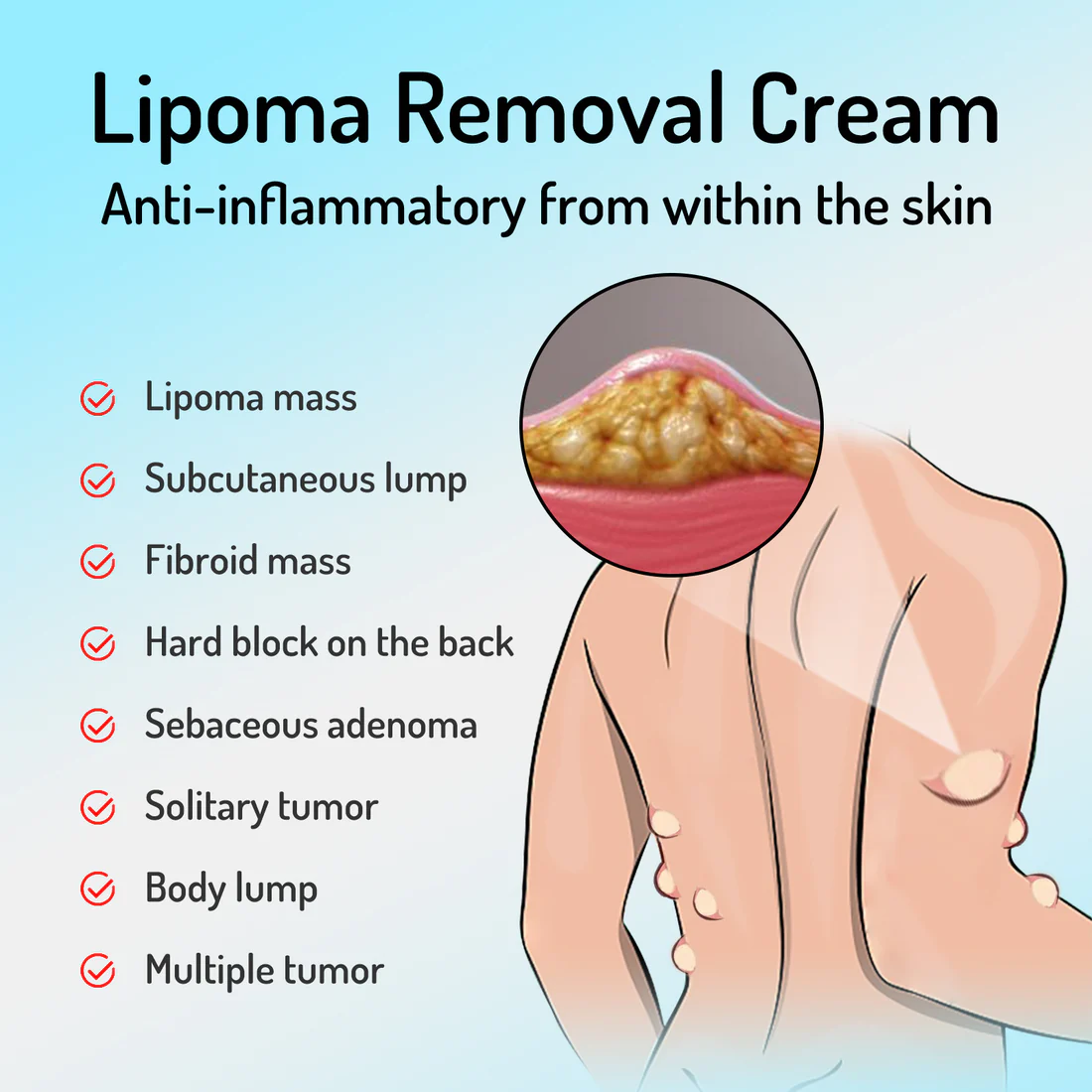 Bee Venom Lipoma Removal Cream - Image 2