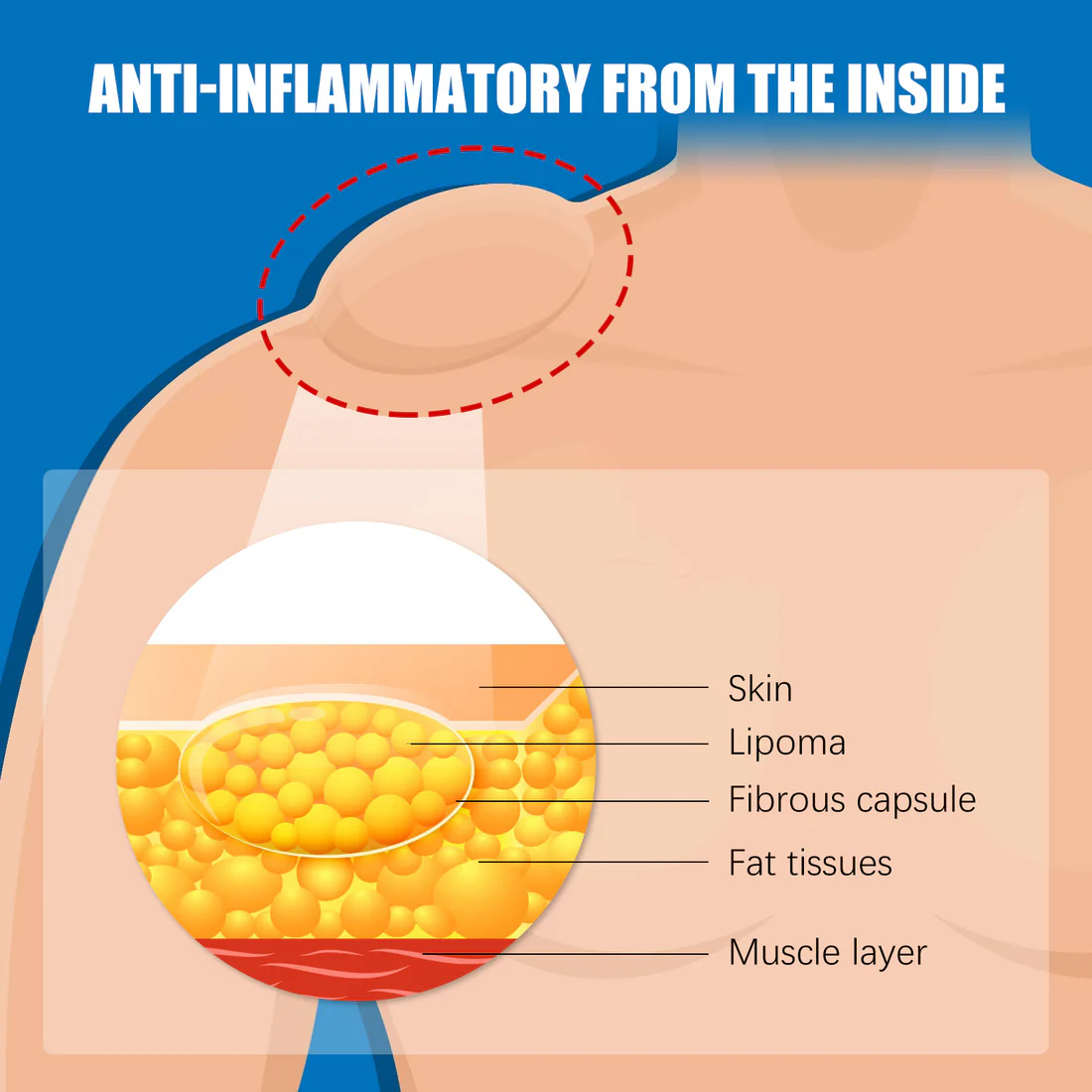 Bee Venom Lipoma Removal Cream - Image 4