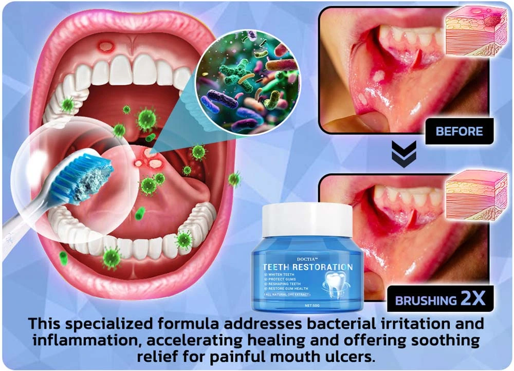 Teeth Restoration Mineral Powder - Image 22
