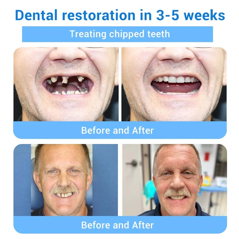 Teeth Restoration Mineral Powder - Image 24