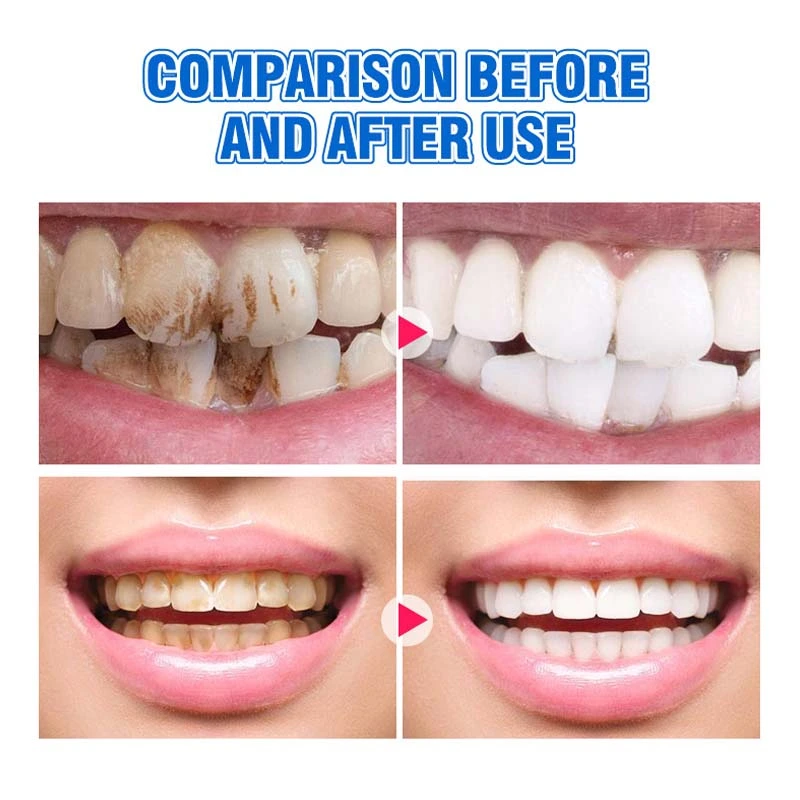Teeth Restoration Mineral Powder - Image 3