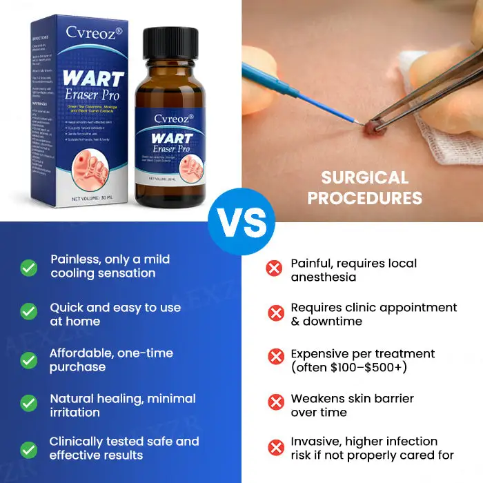 EXCLUSIVE DEAL! 32% OFF - Wart Eraser Pro - Image 5