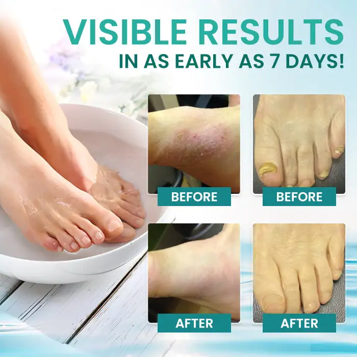 ItchBreak Sea Salt Soak - Image 3