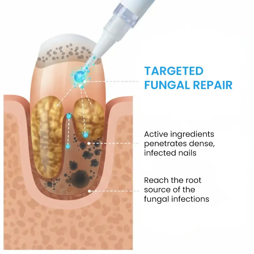NanoFix Nail Repair Pen - Image 4