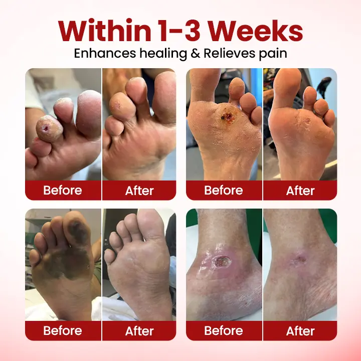 FootGuard Diabetic Care Cream - Image 2