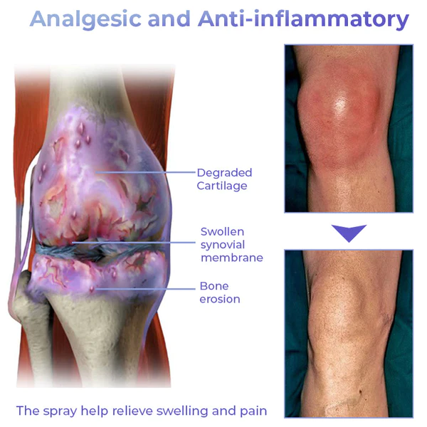 Pro PainRelief Restorative Joint Spray - Image 3