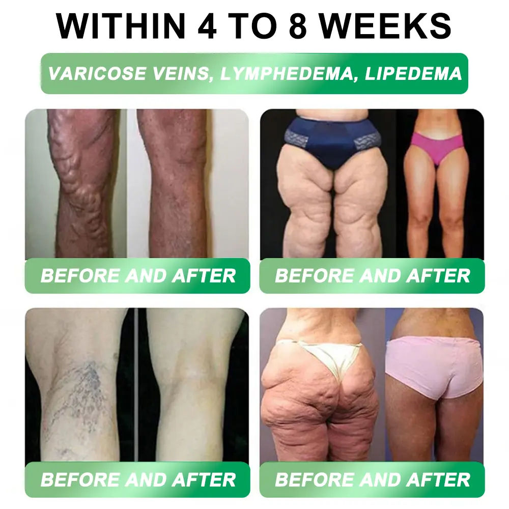 3-in-1 Slim & Healthy Oral Solution - Image 12