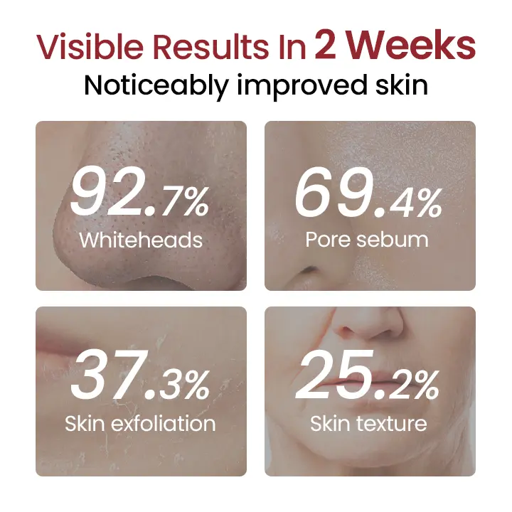 Peel Show Glow Black Rice Ampoule - Image 4