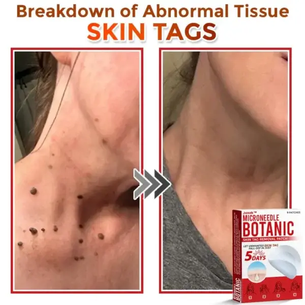 Removal Patch - Image 2