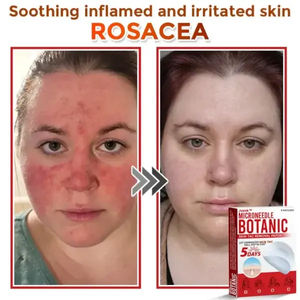 Removal Patch - Image 5