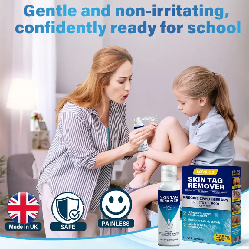 Cryo Treatment Spray Effortlessly remove skin tags and warts-no pain - Image 4
