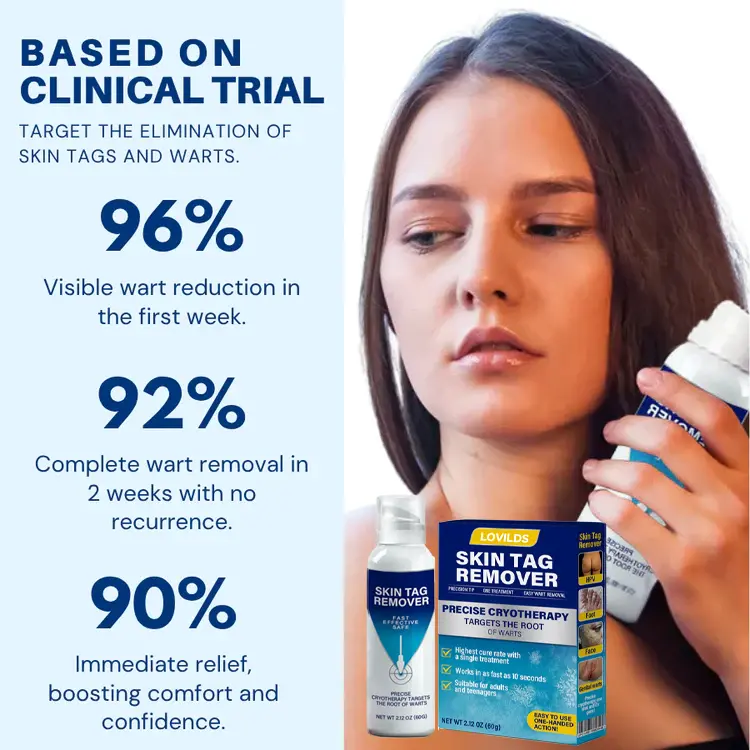 Cryo Treatment Spray Effortlessly remove skin tags and warts-no pain - Image 7
