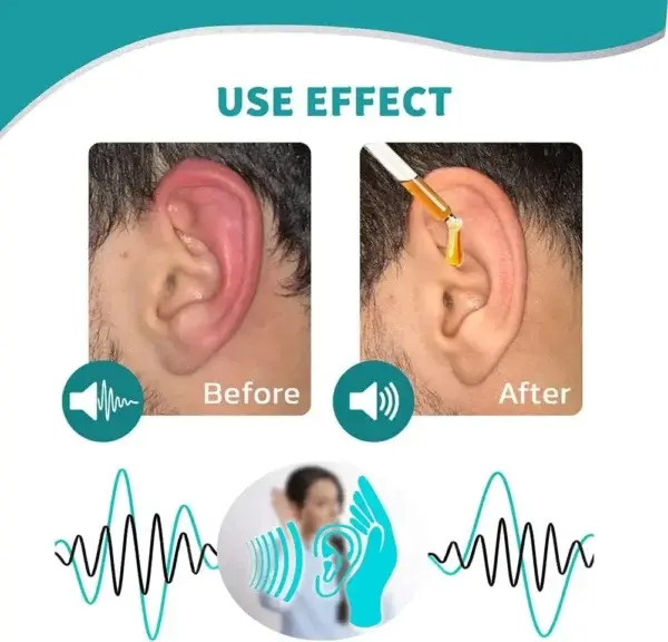 Ear Care Drops - Image 4