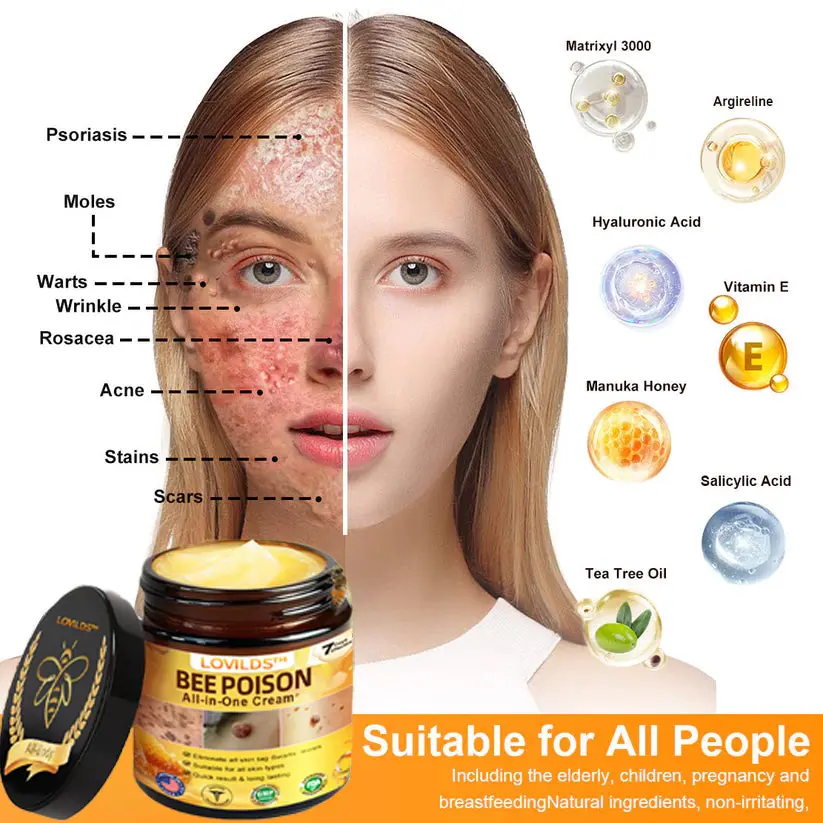 ๐๐๐ Poison ๐๐ฅ๐ฅ-๐ข๐ง-๐๐ง๐ ๐๐ซ๐๐๐ฆ - Image 4