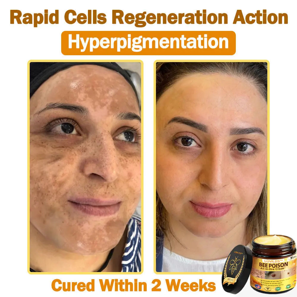 ๐๐๐ Poison ๐๐ฅ๐ฅ-๐ข๐ง-๐๐ง๐ ๐๐ซ๐๐๐ฆ - Image 8