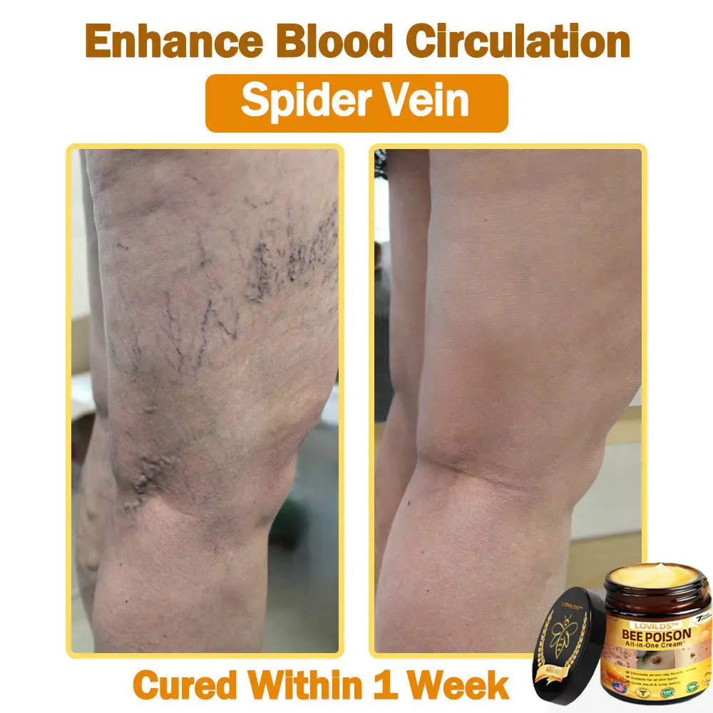 ๐๐๐ Poison ๐๐ฅ๐ฅ-๐ข๐ง-๐๐ง๐ ๐๐ซ๐๐๐ฆ - Image 10