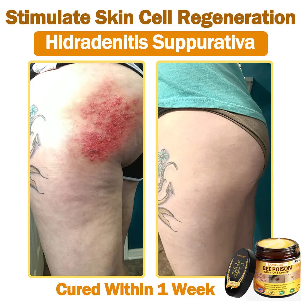 ๐๐๐ Poison ๐๐ฅ๐ฅ-๐ข๐ง-๐๐ง๐ ๐๐ซ๐๐๐ฆ - Image 11