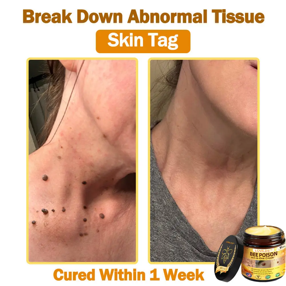 ๐๐๐ Poison ๐๐ฅ๐ฅ-๐ข๐ง-๐๐ง๐ ๐๐ซ๐๐๐ฆ - Image 6