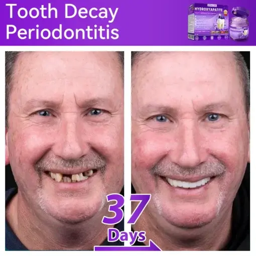 ๐ป๐ฆ๐๐๐๐ฅ๐ฆ๐๐๐๐ก๐๐ก๐ ๐๐๐๐กโ ๐
๐๐ ๐ก๐๐๐๐ก๐๐ฃ๐ ๐๐๐ค๐๐๐ - Image 6