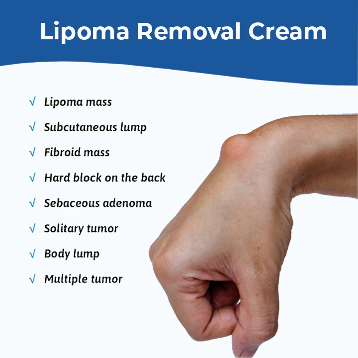 Lipoma Removal Cream - Image 2