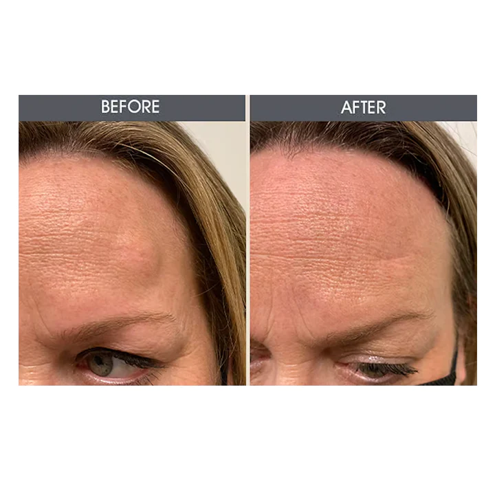 Lipoma Removal Cream - Image 5