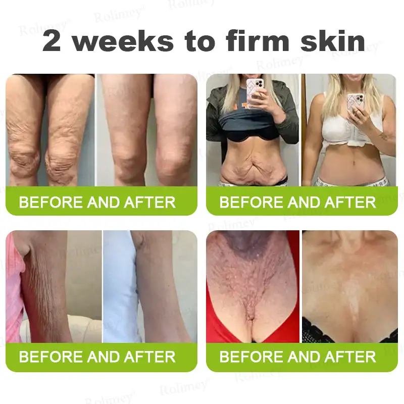 Botox & Vita-A Retinol Shot Wrinkle-Lift Tightening cream - Image 8