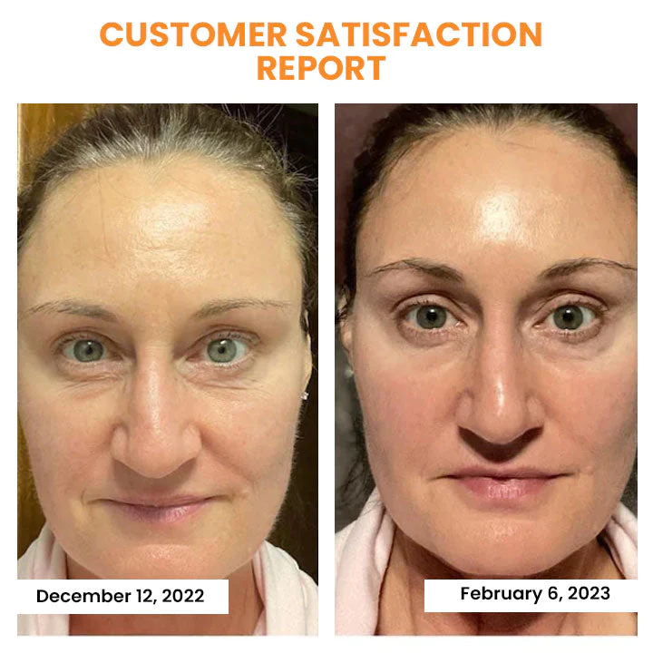 Korean Dermalayr Technology Soluble Collagen Film - Image 4