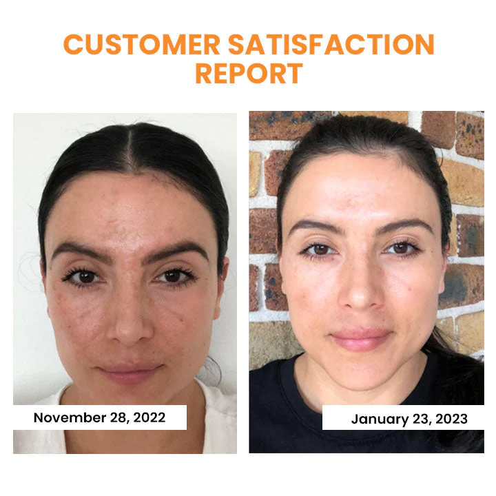 Korean Dermalayr Technology Soluble Collagen Film - Image 5