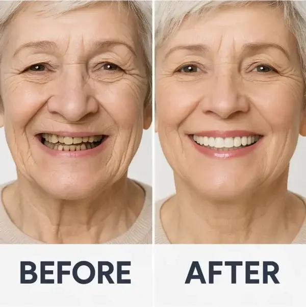 Custom-Fit Functional Dentures Smile with Confidence - Image 5