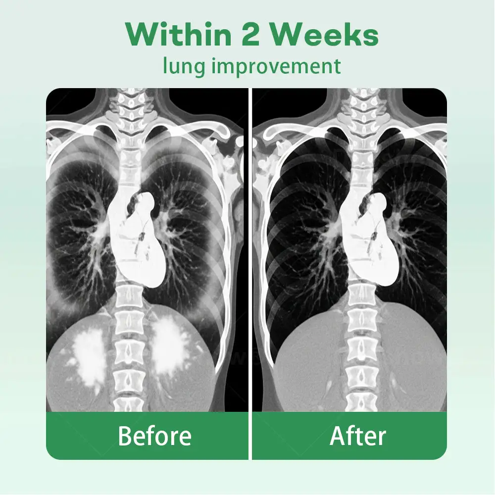 Herbal Lung Cleansing Inhaier - Image 3