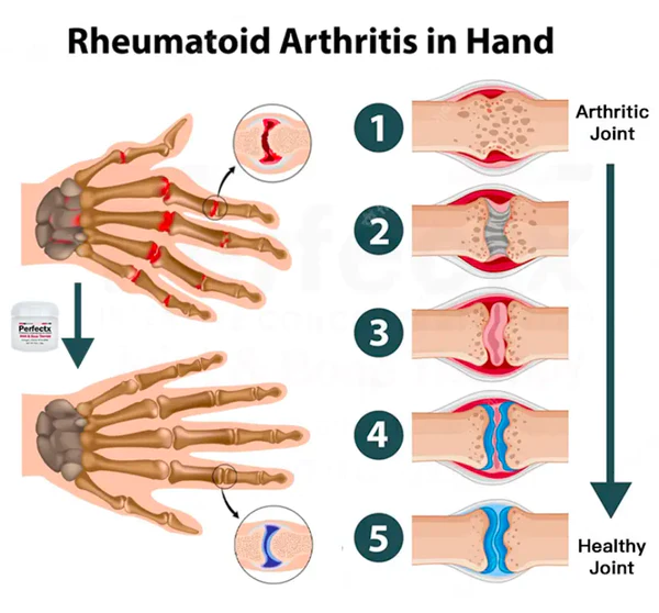 Joint & Bone Therapy Cream - Image 6